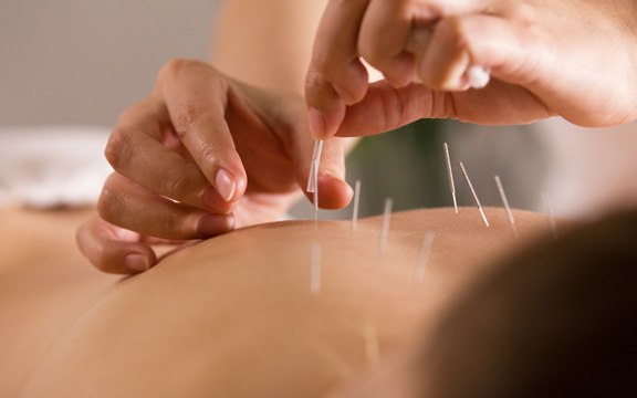 Pain management treatment using acupuncture