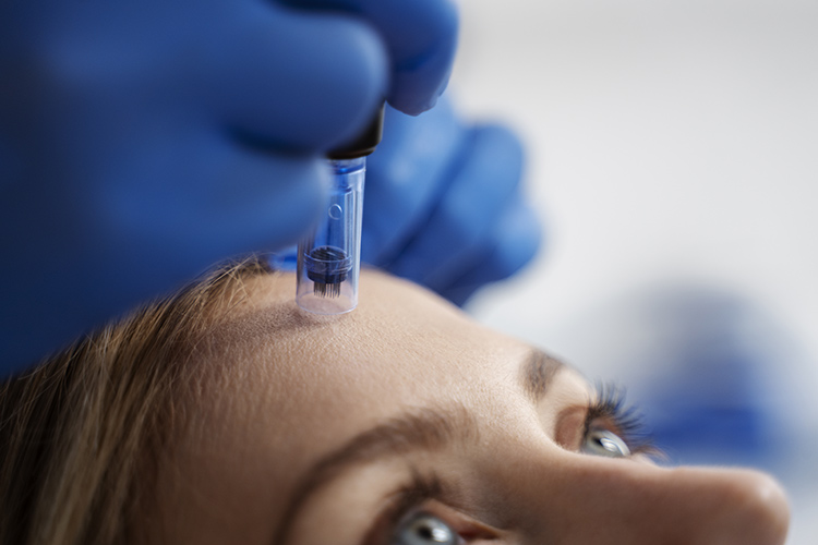 Skin Care | Aesthetic Treatments | Microneedling